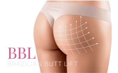 Give your bottom a boost with a Brazilian Butt Lift
