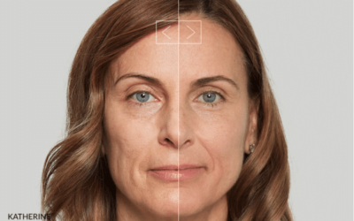 Turning back the clock with Sculptra® Aesthetic