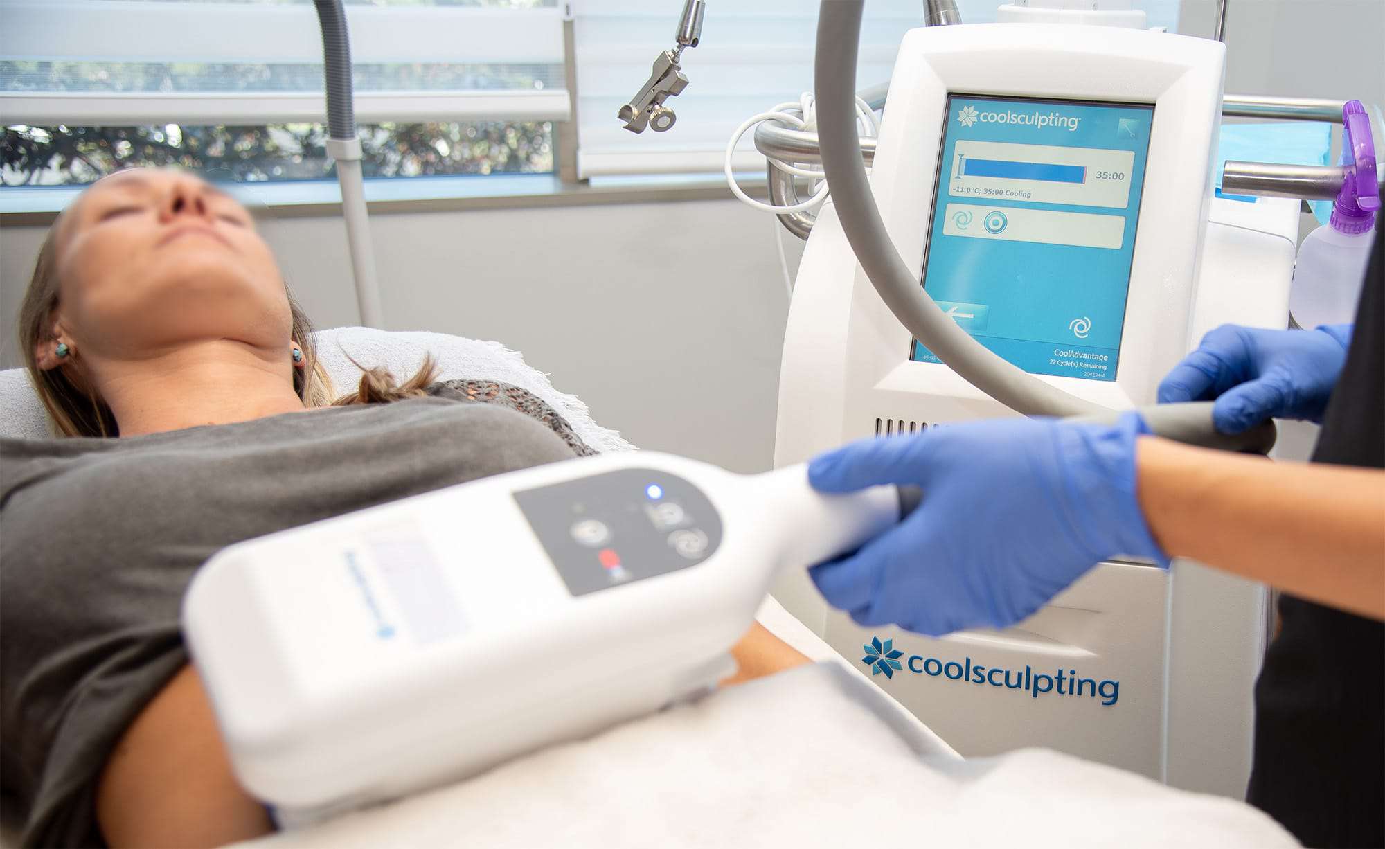 CoolSculpting