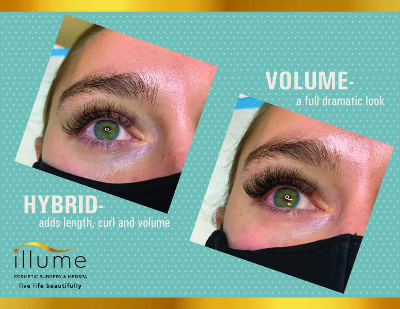 Eyelash Enhancement In Milwaukee And Waukesha Illume Cosmetic Surgery And Medspa 6239