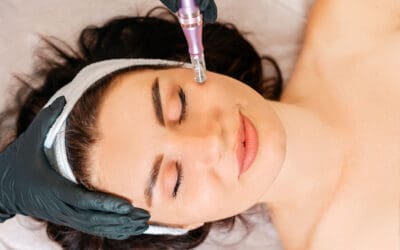 A Clear Difference: The Benefits of Potenza RF Microneedling