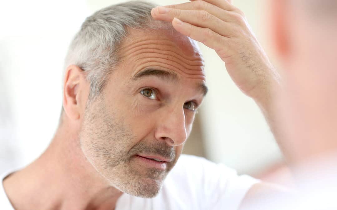 FUE Hair Transplant: Boost Your Self-Image with Thicker, Fuller Hair