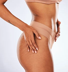 Liposuction