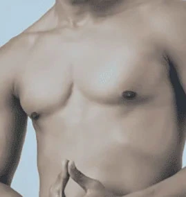 Male Breast Reduction