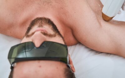 Men’s Laser Hair Removal: Benefits and Procedure Timing
