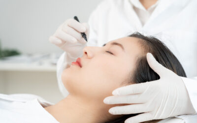 What to Expect After a Rhinoplasty Surgery