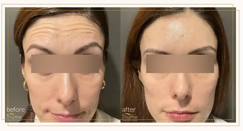 physician-supervised-medspas Medspa