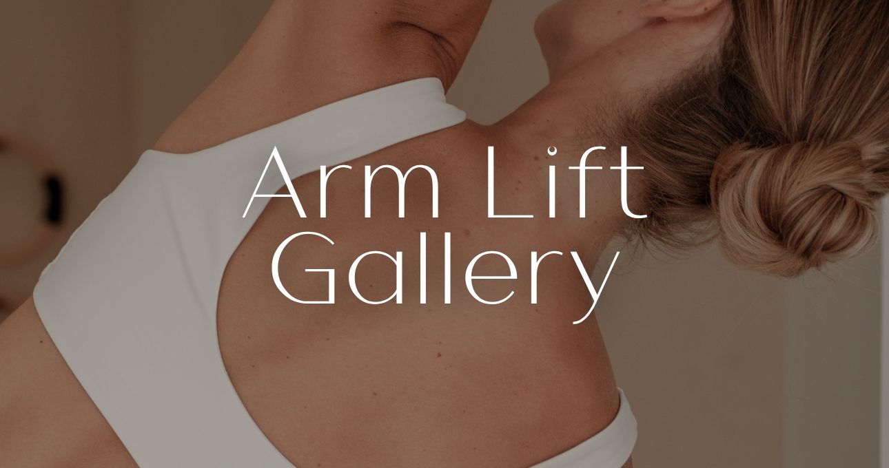 B&A Gallery Arm Lift