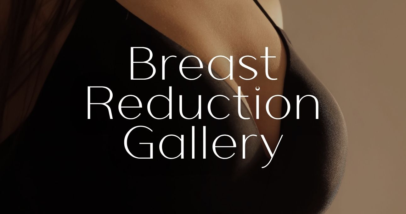 B&A Gallery Breast Reduction