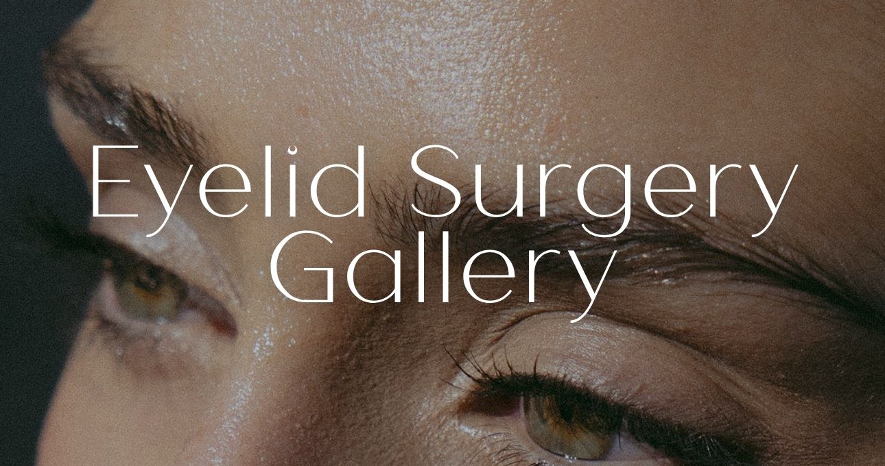 B&A Gallery Eyelid