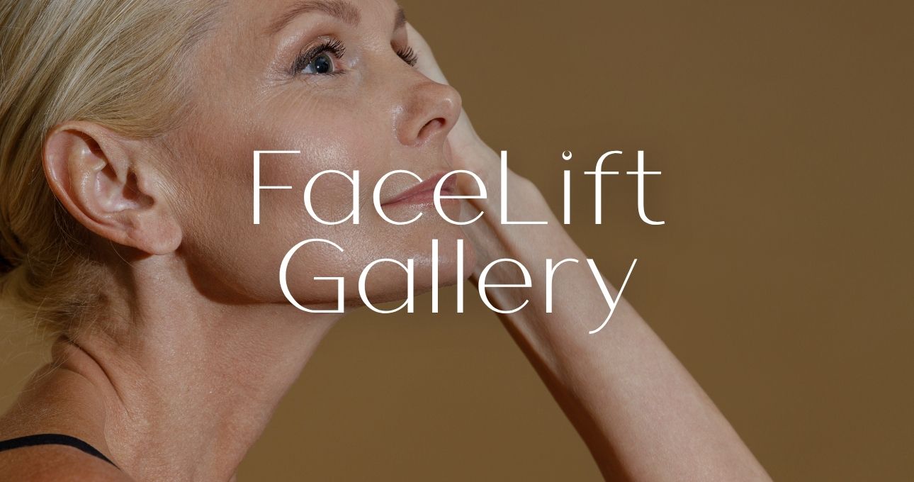 B&A Gallery Facelift (2)