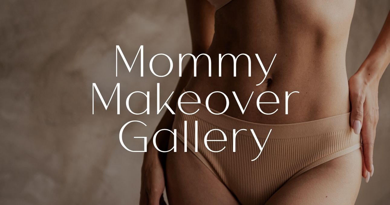 B&A Gallery Mommy Makeover