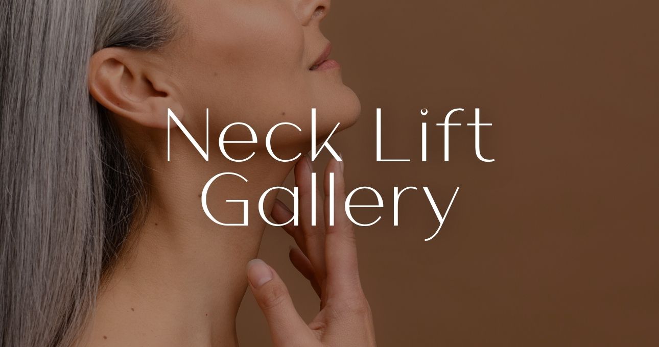 B&A Gallery Neck Lift