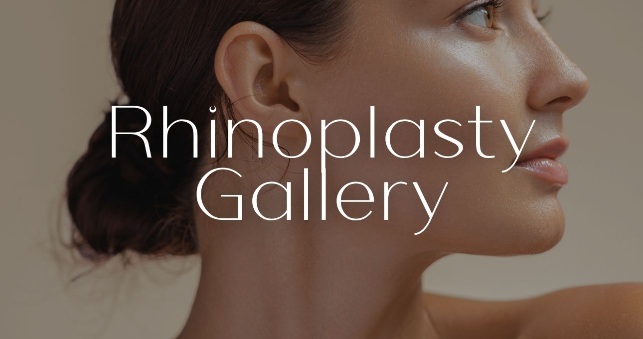 B&A Gallery Rhinoplasty